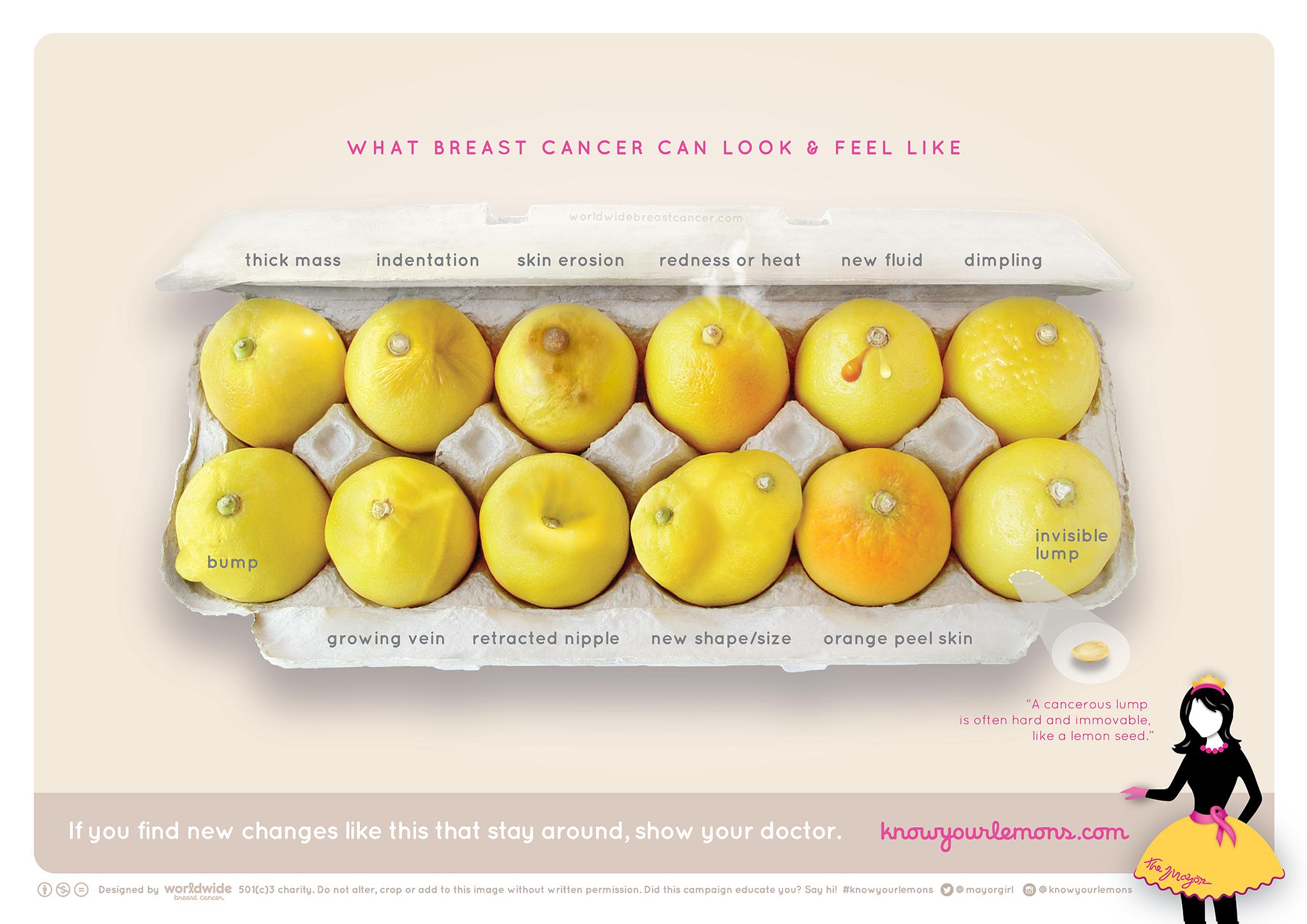 Καρκίνος μαστού: Δείτε τα λεμόνια που αποκαλύπτουν τα συμπτώματά του